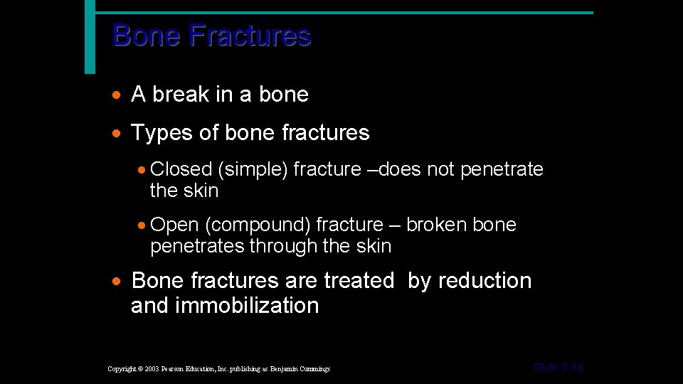 Bone Fractures · A break in a bone · Types of bone fractures ·