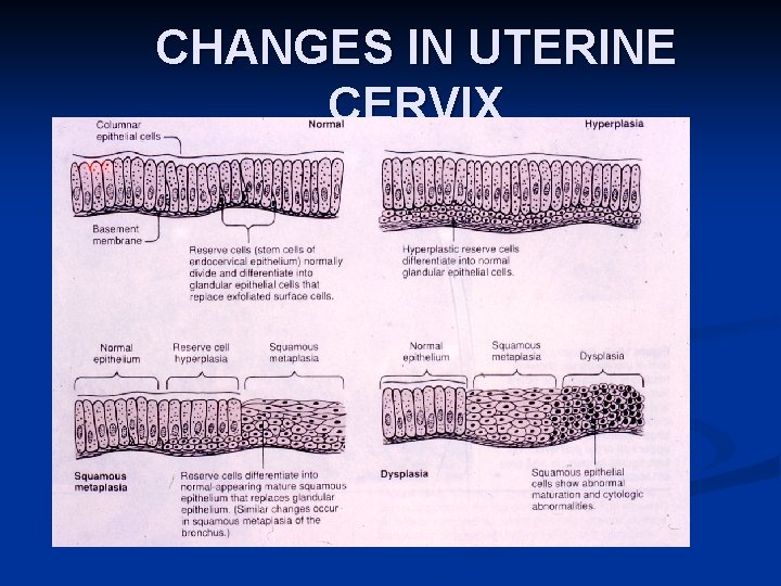 CHANGES IN UTERINE CERVIX 