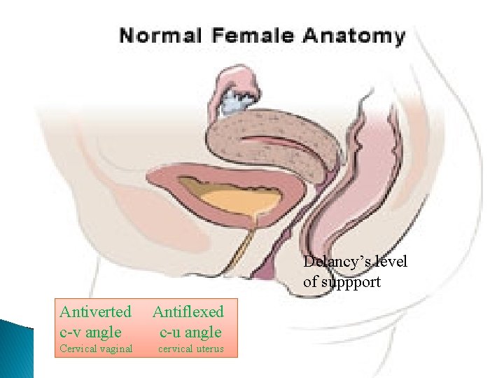 Delancy’s level of suppport Antiverted c-v angle Antiflexed c-u angle Cervical vaginal cervical uterus