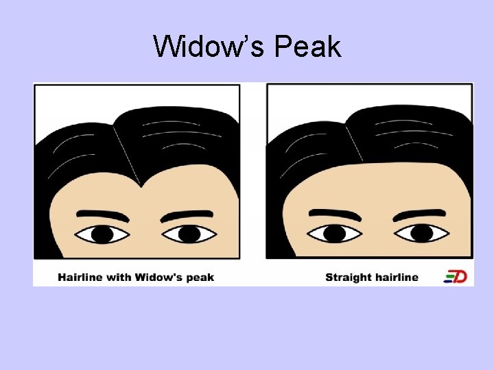 Widow’s Peak 