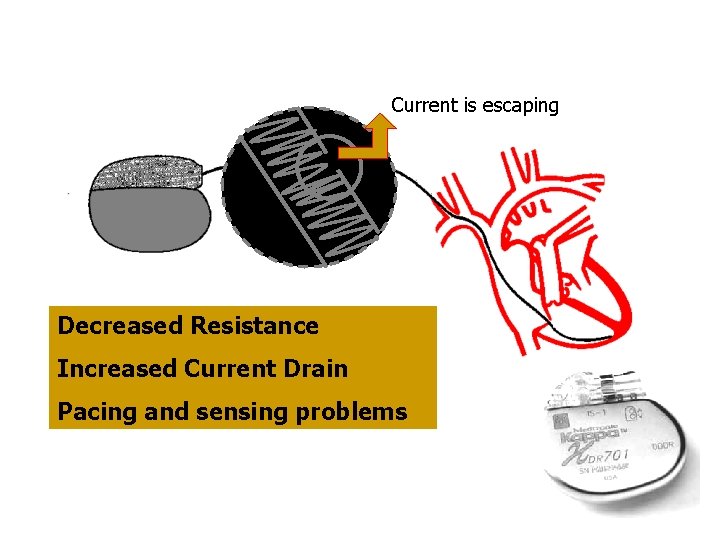 Current is escaping Decreased Resistance Increased Current Drain Pacing and sensing problems 