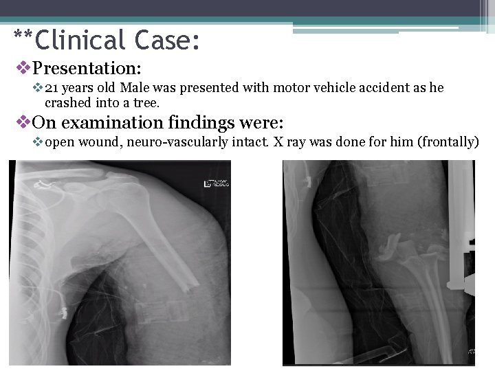 **Clinical Case: v. Presentation: v 21 years old Male was presented with motor vehicle