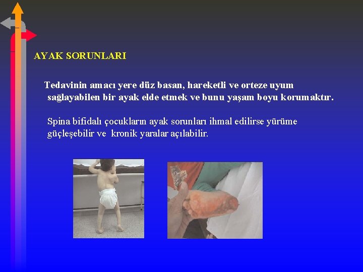 AYAK SORUNLARI Tedavinin amacı yere düz basan, hareketli ve orteze uyum sağlayabilen bir ayak