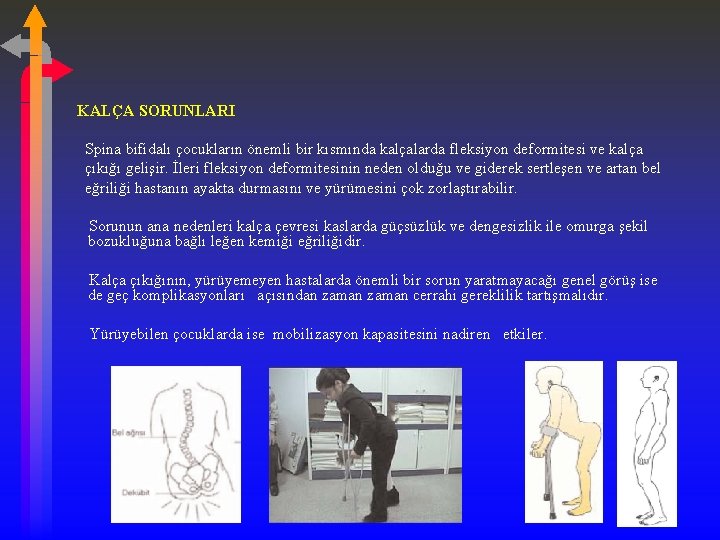 KALÇA SORUNLARI Spina bifidalı çocukların önemli bir kısmında kalçalarda fleksiyon deformitesi ve kalça çıkığı