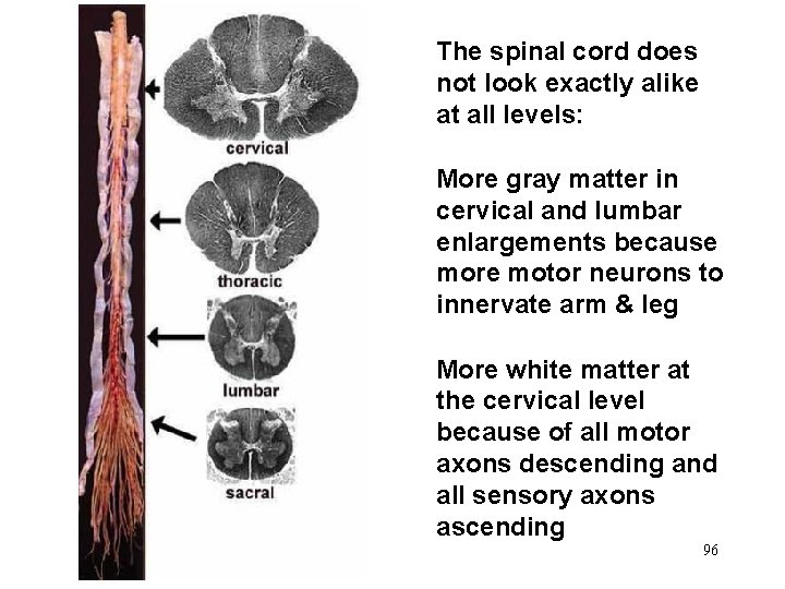 The spinal cord does not look exactly alike at all levels: More gray matter The spinal cord does not look exactly alike at all levels: More gray matter