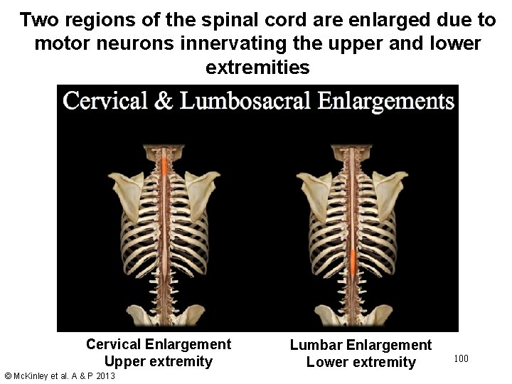 Two regions of the spinal cord are enlarged due to motor neurons innervating the Two regions of the spinal cord are enlarged due to motor neurons innervating the