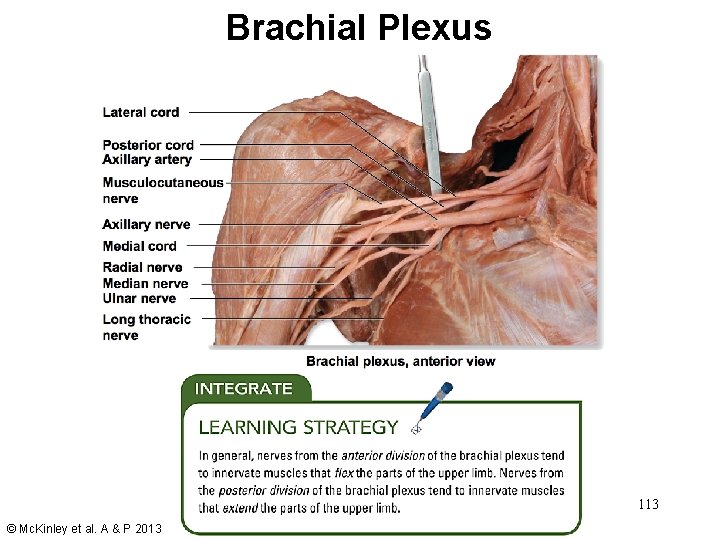 Brachial Plexus 113 © Mc. Kinley et al. A & P 2013 Brachial Plexus 113 © Mc. Kinley et al. A & P 2013