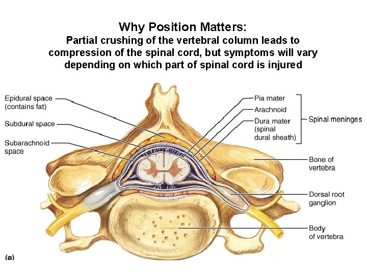 Why Position Matters: Partial crushing of the vertebral column leads to compression of the Why Position Matters: Partial crushing of the vertebral column leads to compression of the