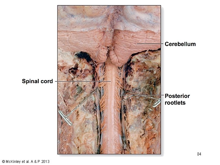 84 © Mc. Kinley et al. A & P 2013 84 © Mc. Kinley et al. A & P 2013