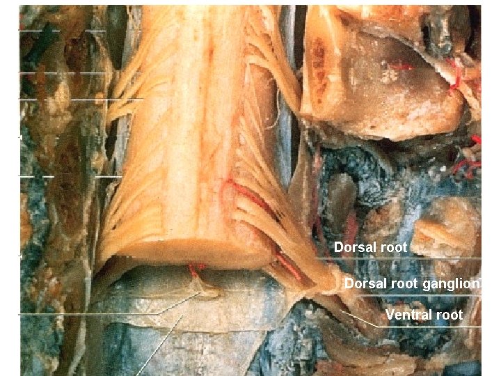 Dorsal root ganglion Ventral root 85 Dorsal root ganglion Ventral root 85