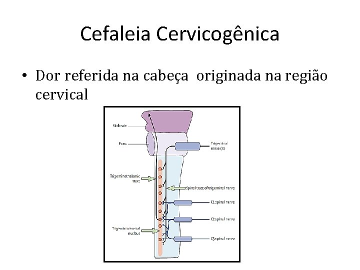 Cefaleia Cervicogênica • Dor referida na cabeça originada na região cervical 