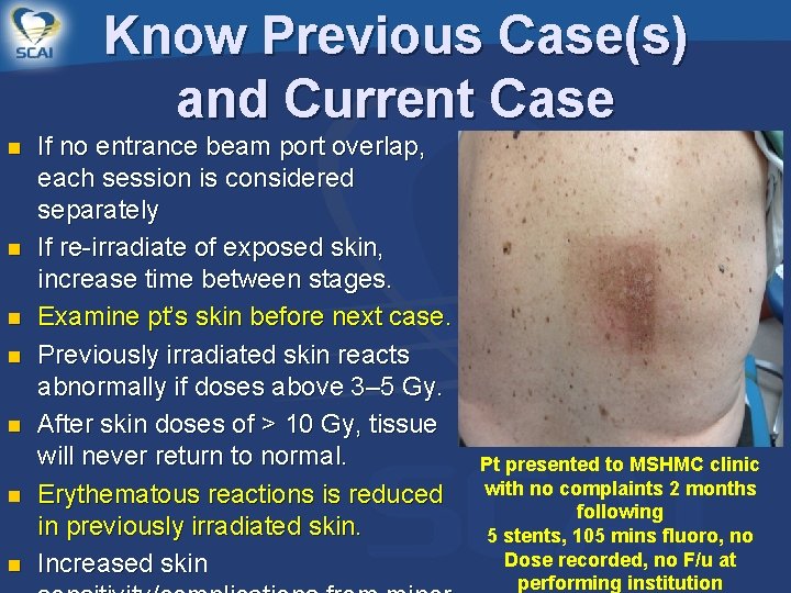 Know Previous Case(s) and Current Case n n n n If no entrance beam