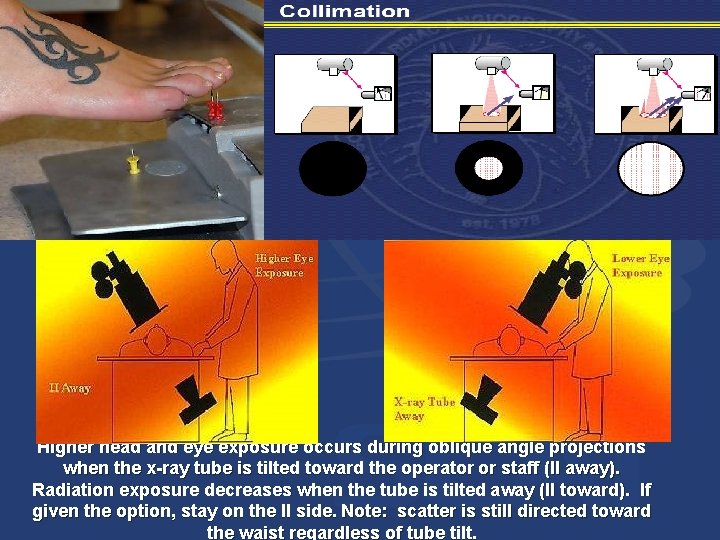 Higher head and eye exposure occurs during oblique angle projections when the x-ray tube