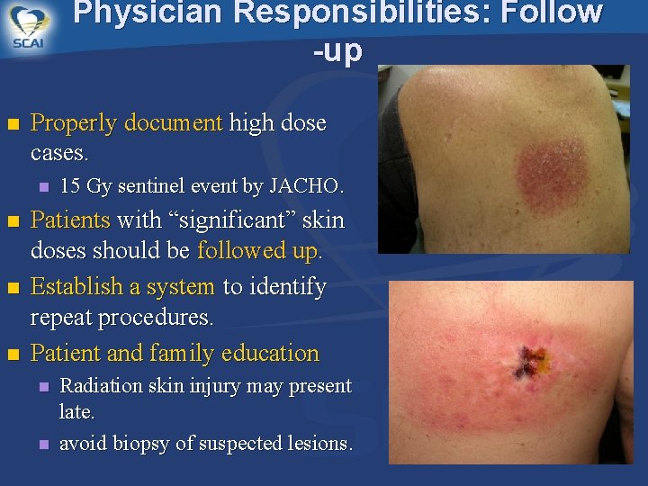 Physician Responsibilities: Follow -up n Properly document high dose cases. n n 15 Gy
