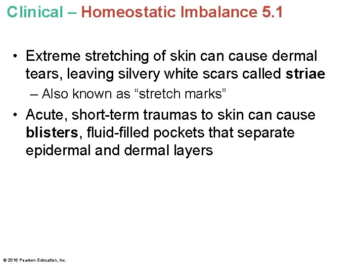 Clinical – Homeostatic Imbalance 5. 1 • Extreme stretching of skin cause dermal tears,