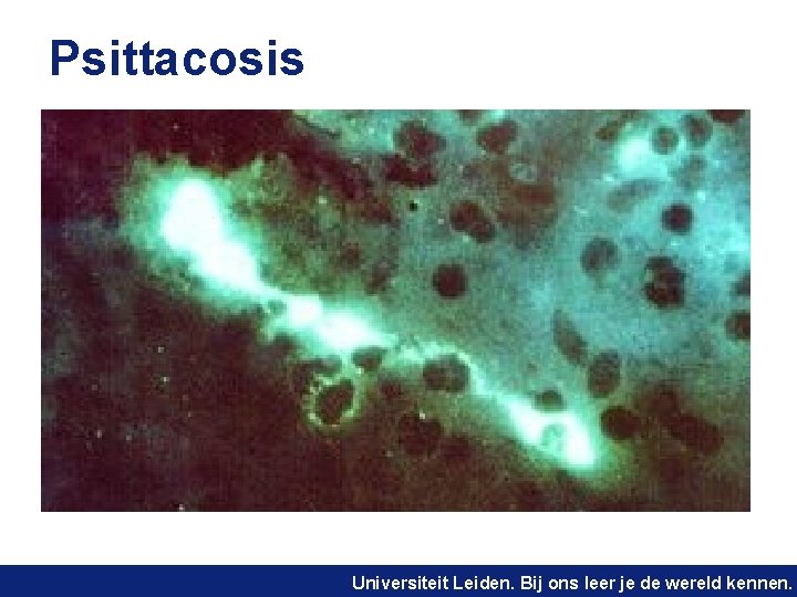 Psittacosis Universiteit Leiden. Bij ons leer je de wereld kennen. 
