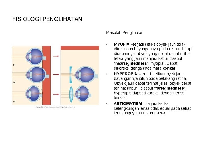 FISIOLOGI PENGLIHATAN Masalah Penglihatan • • • MYOPIA –terjadi ketika obyek jauh tidak difokuskan