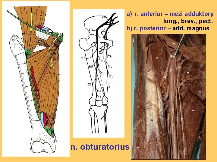 a) r. anterior – mezi adduktory long. , brev. , pect. b) r. posterior