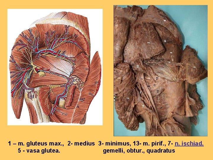 1 – m. gluteus max. , 2 - medius 3 - minimus, 13 -