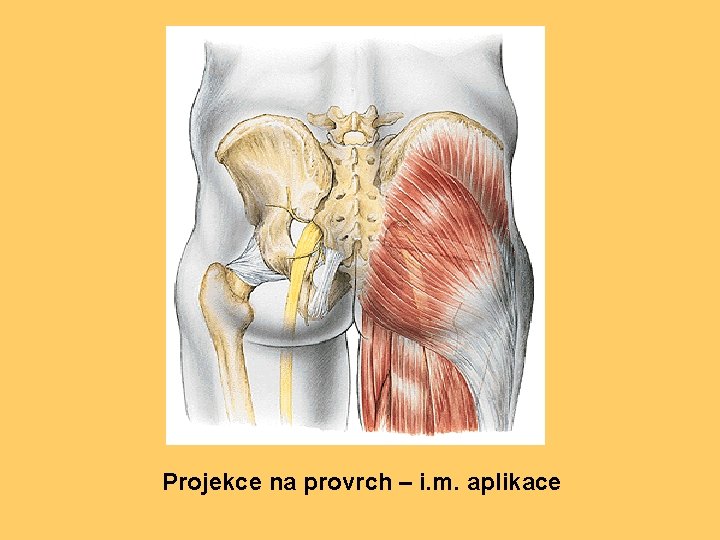 Projekce na provrch – i. m. aplikace 