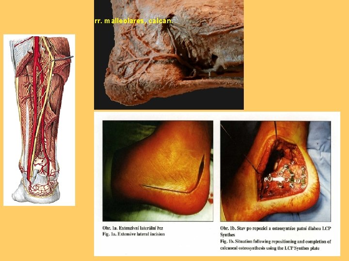 rr. malleolares, calcan. rr. calcanei lat. 