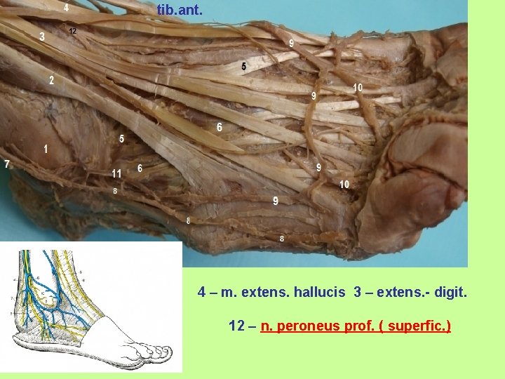 tib. ant. 4 – m. extens. hallucis 3 – extens. - digit. 12 –