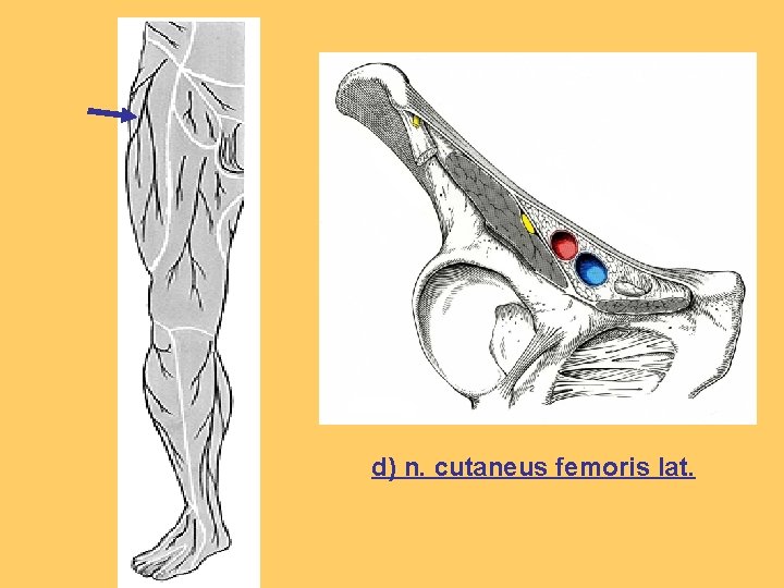 d) n. cutaneus femoris lat. 