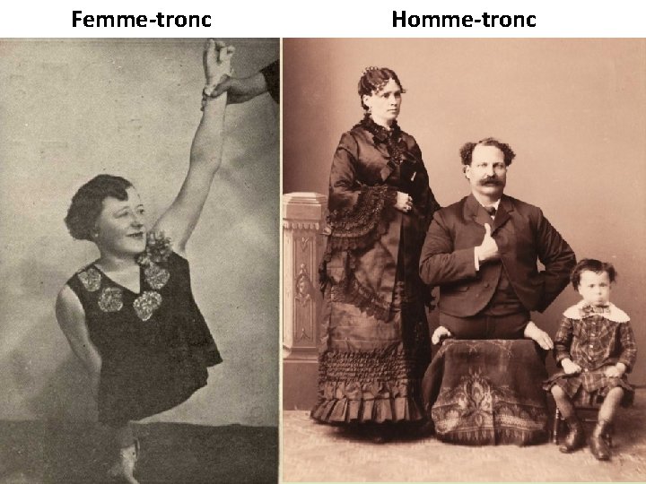 Femme-tronc Homme-tronc 
