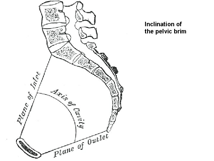Inclination of the pelvic brim 