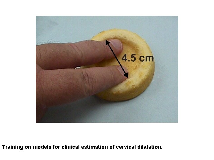 Training on models for clinical estimation of cervical dilatation. 