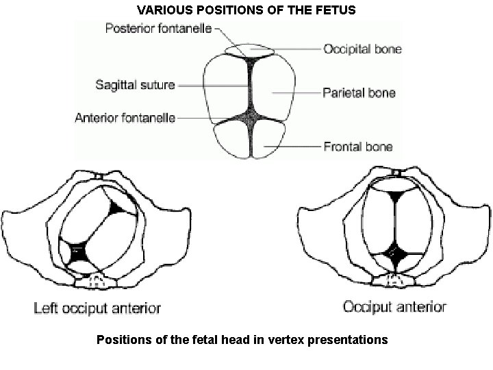 VARIOUS POSITIONS OF THE FETUS Positions of the fetal head in vertex presentations 