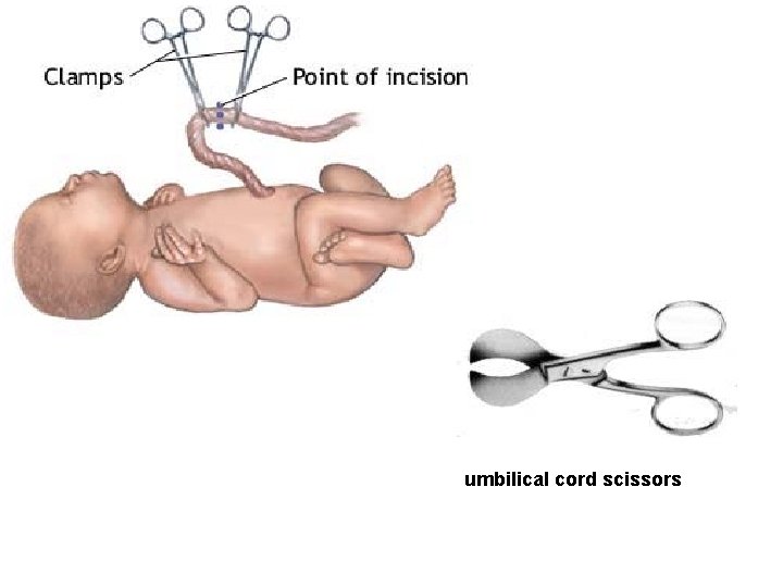CLAMPING & CUTTING THE UMBILICAL CORD umbilical cord scissors 