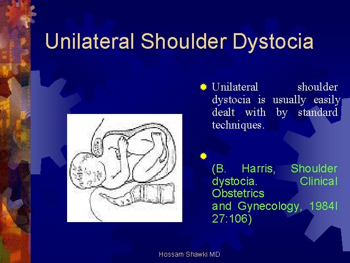 Unilateral Shoulder Dystocia ® Unilateral shoulder dystocia is usually easily dealt with by standard