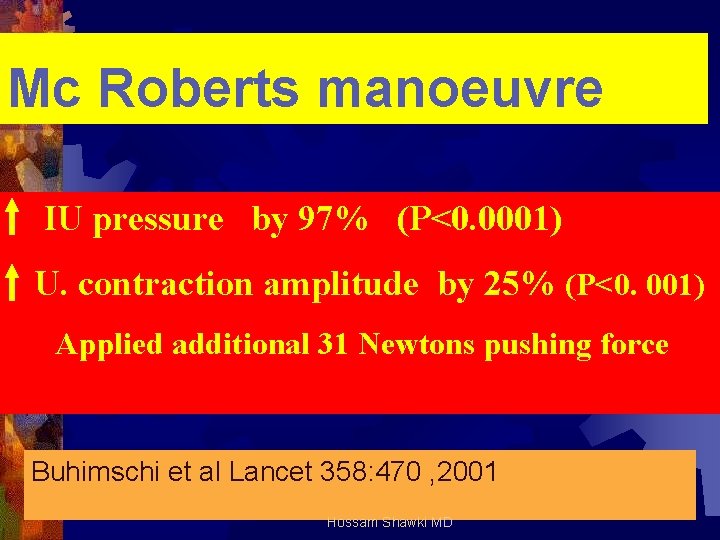 Mc Roberts manoeuvre IU pressure by 97% (P<0. 0001) U. contraction amplitude by 25%