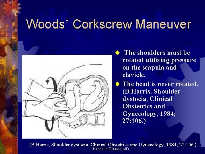 Woods’ Corkscrew Maneuver The shoulders must be rotated utilizing pressure on the scapula and