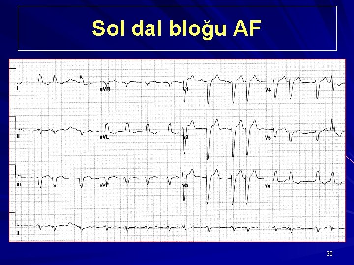 Sol dal bloğu AF 35 