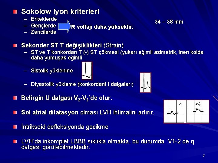 Sokolow lyon kriterleri – Erkeklerde – Gençlerde – Zencilerde R voltajı daha yüksektir. 34