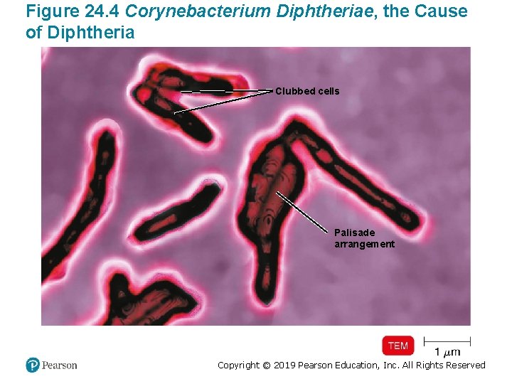 Figure 24. 4 Corynebacterium Diphtheriae, the Cause of Diphtheria Clubbed cells Palisade arrangement Copyright