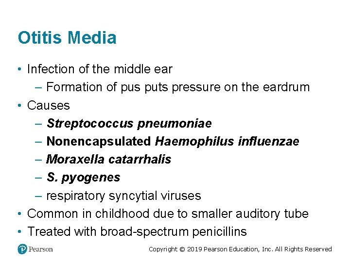 Otitis Media • Infection of the middle ear – Formation of pus puts pressure
