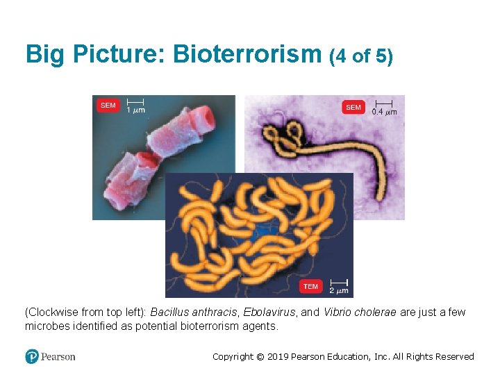 Big Picture: Bioterrorism (4 of 5) (Clockwise from top left): Bacillus anthracis, Ebolavirus, and