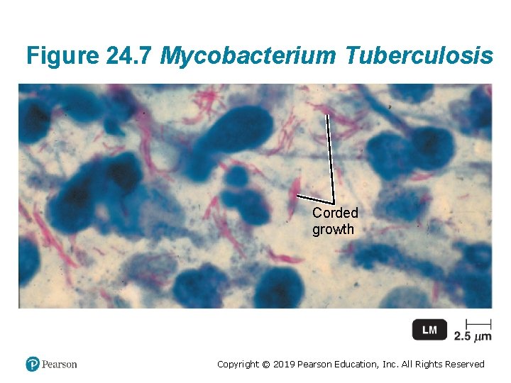 Figure 24. 7 Mycobacterium Tuberculosis Corded growth Copyright © 2019 Pearson Education, Inc. All