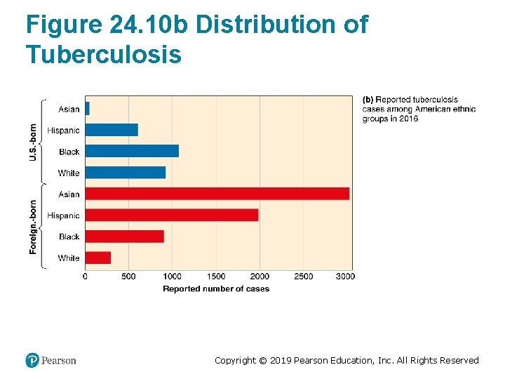 Figure 24. 10 b Distribution of Tuberculosis Copyright © 2019 Pearson Education, Inc. All