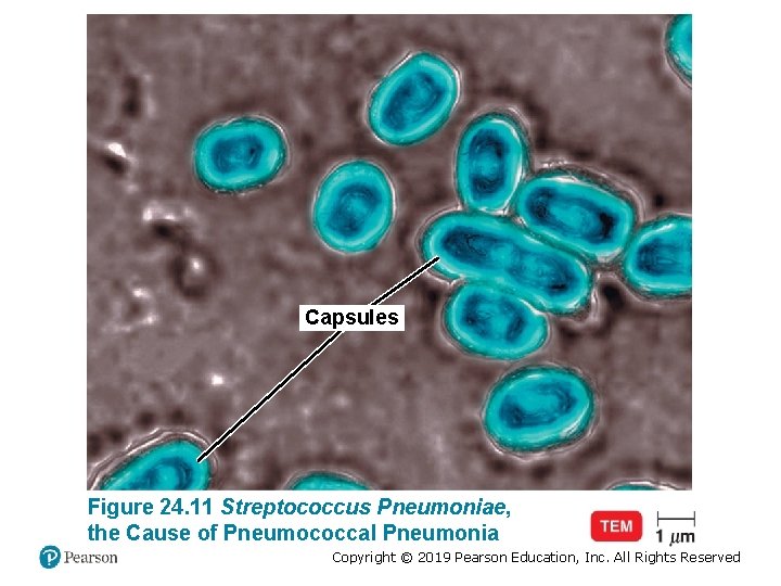 Capsules Figure 24. 11 Streptococcus Pneumoniae, the Cause of Pneumococcal Pneumonia Copyright © 2019