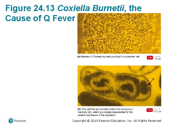 Figure 24. 13 Coxiella Burnetii, the Cause of Q Fever Copyright © 2019 Pearson