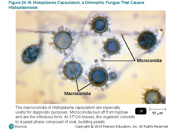 Figure 24. 15 Histoplasma Capsulatum, a Dimorphic Fungus That Causes Histoplasmosis Microconidia Macroconidia The