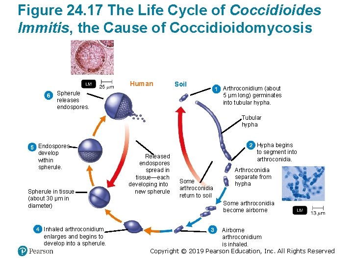 Figure 24. 17 The Life Cycle of Coccidioides Immitis, the Cause of Coccidioidomycosis Human