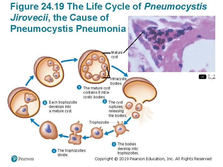 Figure 24. 19 The Life Cycle of Pneumocystis Jirovecii, the Cause of Pneumocystis Pneumonia