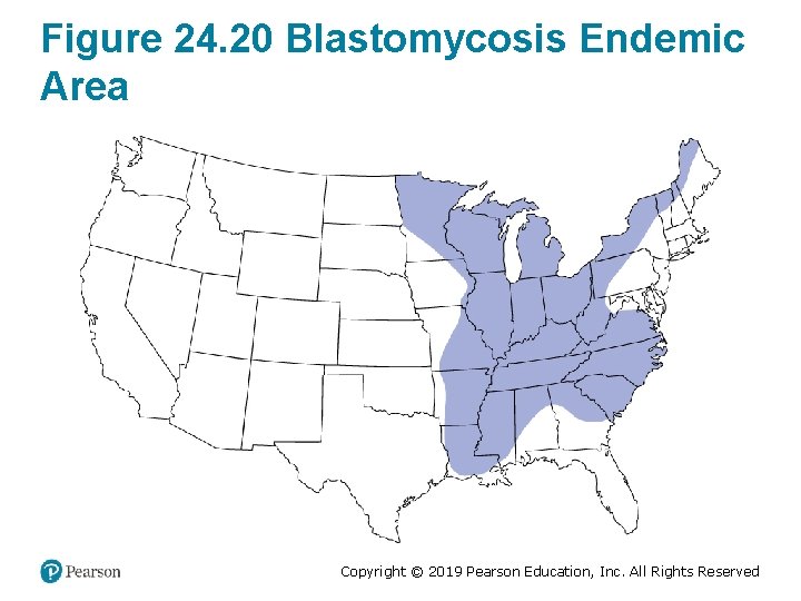 Figure 24. 20 Blastomycosis Endemic Area Copyright © 2019 Pearson Education, Inc. All Rights