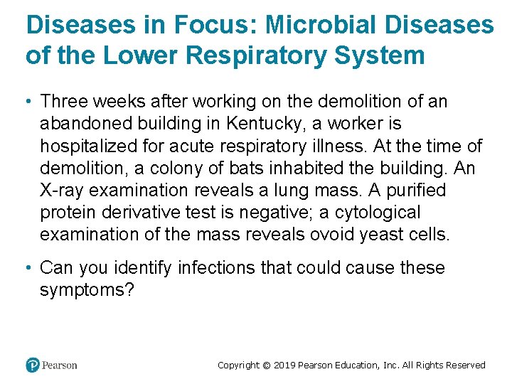Diseases in Focus: Microbial Diseases of the Lower Respiratory System • Three weeks after