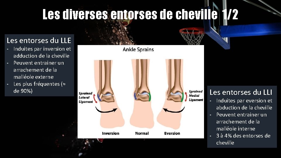 Les diverses entorses de cheville 1/2 Les entorses du LLE - Induites par inversion